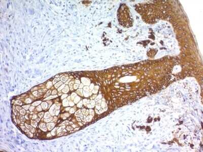 Immunohistochemistry-Paraffin: Cytokeratin, HMW Antibody (KRTH/1576R) [NBP2-53164]