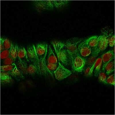 Immunocytochemistry/ Immunofluorescence: Cytokeratin, HMW Antibody (KRTH/2147R) - Azide and BSA Free [NBP3-08361]