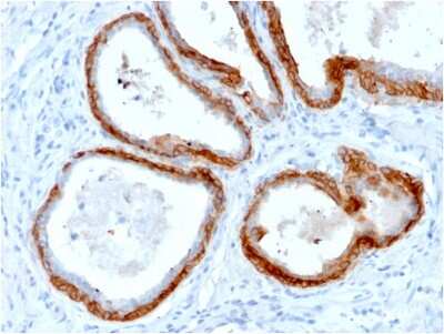 Immunohistochemistry-Paraffin: Cytokeratin, HMW Antibody (KRTH/2147R) - Azide and BSA Free [NBP3-08361]