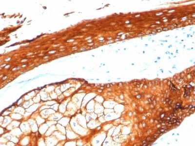 Immunohistochemistry-Paraffin: Cytokeratin, HMW Antibody (KRTH/4392R) - Azide and BSA Free [NBP3-08421]