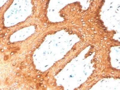 Immunohistochemistry-Paraffin: Cytokeratin, HMW Antibody (KRTH/4392R) [NBP3-07286]