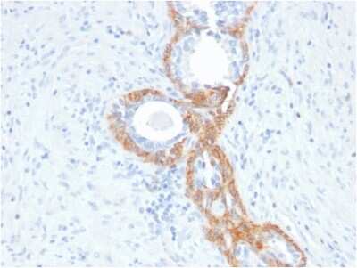 Immunohistochemistry-Paraffin: Cytokeratin, HMW Antibody (rKRTH/2148) - Azide and BSA Free [NBP3-08283]