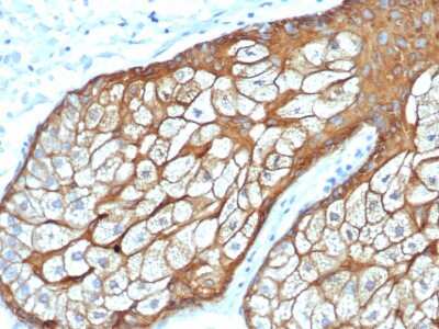 Immunohistochemistry-Paraffin: Cytokeratin, HMW Antibody (rKRTH/6617) - Azide and BSA Free [NBP3-08675]