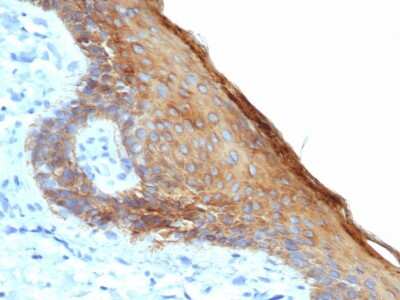 Immunohistochemistry-Paraffin: Cytokeratin, HMW Antibody (rKRTH/6617) [NBP3-07645]