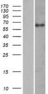 Western Blot: Cytokeratin, HMW Overexpression Lysate [NBP2-07126]