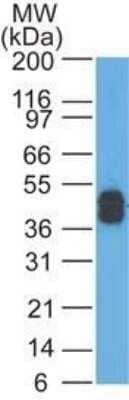 Western Blot: Cytokeratin, LMW Antibody (AE-1)Azide and BSA Free [NBP2-33178]