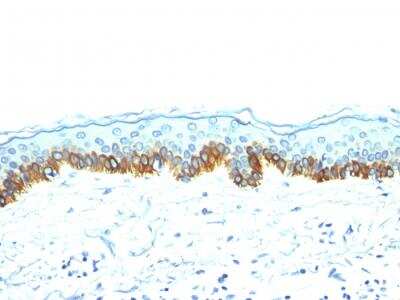 Immunohistochemistry-Paraffin: Cytokeratin, LMW Antibody (AE-1) - IHC-Prediluted [NBP2-48267]