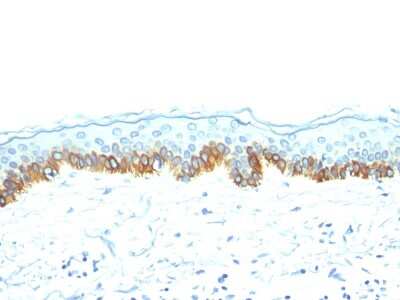 Immunohistochemistry-Paraffin: Cytokeratin, LMW Antibody (AE-1) [NBP2-29411]