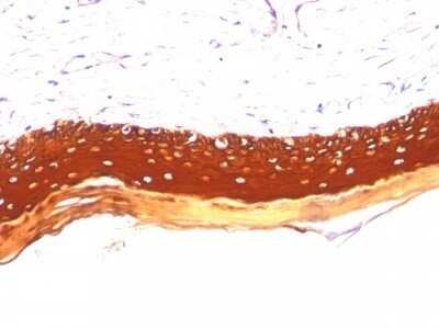 Immunohistochemistry-Paraffin: Cytokeratin, LMW Antibody (KRTL/1077) - Azide and BSA Free [NBP2-47798]