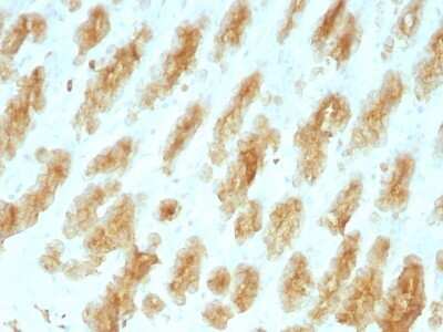 Immunohistochemistry-Paraffin: Cytokeratin, LMW Antibody (KRTL/1077) - Azide and BSA Free [NBP2-47798]