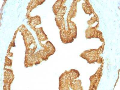 Immunohistochemistry-Paraffin: Cytokeratin, LMW Antibody (KRTL/1077) - IHC-Prediluted [NBP2-48269]