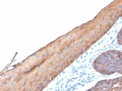 Immunohistochemistry-Paraffin: Cytokeratin, LMW Antibody (KRTL/4440R) - Azide and BSA Free [NBP3-08422]