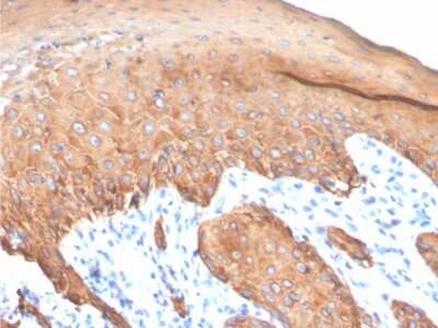 Immunohistochemistry-Paraffin: Cytokeratin, LMW Antibody (KRTL/4440R) - Azide and BSA Free [NBP3-08422]