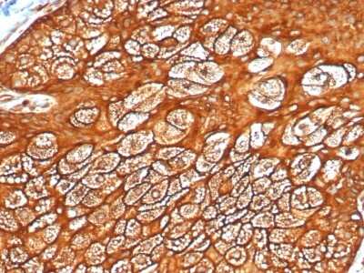 Immunohistochemistry-Paraffin: Cytokeratin, LMW Antibody (KRTL/4440R) [NBP3-07287]