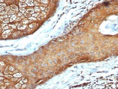 Immunohistochemistry-Paraffin: Cytokeratin, LMW Antibody (rKRTL/6616) - Azide and BSA Free [NBP3-08674]