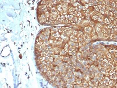 Immunohistochemistry-Paraffin: Cytokeratin, LMW Antibody (rKRTL/6616) - Azide and BSA Free [NBP3-08674]