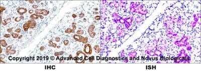 Detection of Cytokeratin, pan in Human Tissue in Dual RNAscope ISH-IHC