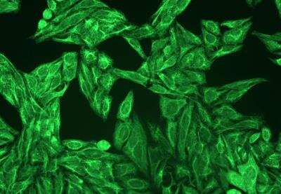Immunocytochemistry/ Immunofluorescence: Cytokeratin, pan Antibody (C-11) - BSA Free [NBP1-48348]