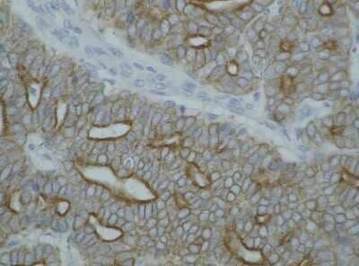 Immunohistochemistry-Paraffin: Cytokeratin, pan Antibody (C-11) - BSA Free [NBP1-48348]