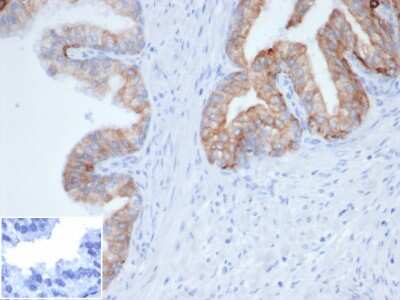 Immunohistochemistry-Paraffin: Cytokeratin, pan Antibody (Cocktail PCK/4933R) [NBP3-13910]