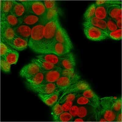 Immunocytochemistry/ Immunofluorescence: Cytokeratin, pan Antibody (KRT/1877R) - Azide and BSA Free [NBP3-08398]