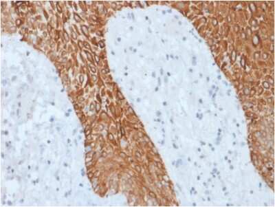 Immunohistochemistry-Paraffin: Cytokeratin, pan Antibody (KRT/1877R) [NBP3-07280]