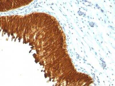 Immunohistochemistry-Paraffin: Cytokeratin, pan Antibody (KRT/457) - Azide and BSA Free [NBP2-47669]