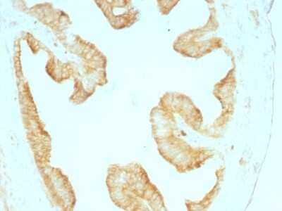 Immunohistochemistry-Paraffin: Cytokeratin, pan Antibody (KRT/457) - Azide and BSA Free [NBP2-47669]