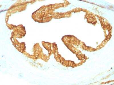 Immunohistochemistry-Paraffin: Cytokeratin, pan Antibody (KRTL/1077 + KRTH/1076) - IHC-Prediluted [NBP2-48299]