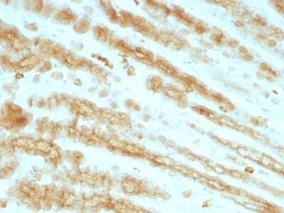 Immunohistochemistry-Paraffin: Cytokeratin, pan Antibody (KRTL/1077 + KRTH/1076) [NBP2-44367]