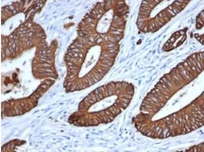 Immunohistochemistry-Paraffin: Cytokeratin, pan Antibody (MonoPoly/7249R) - (MonoPoly) [NBP3-13914]