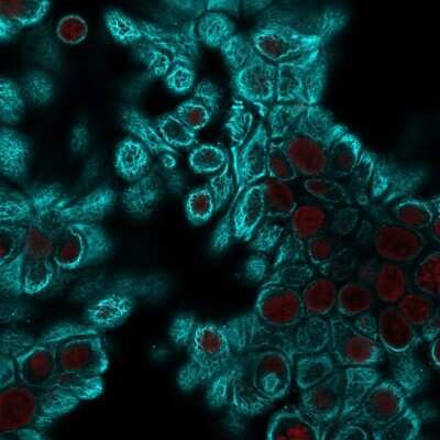 Immunocytochemistry/ Immunofluorescence: Cytokeratin, pan Antibody (PAN-CK (Cocktail)) - Azide and BSA Free [NBP2-76425]