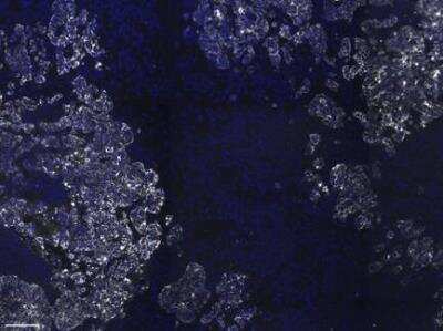Immunohistochemistry-Paraffin: Cytokeratin, pan Antibody (PAN-CK (Cocktail)) - Azide and BSA Free [NBP2-76425]
