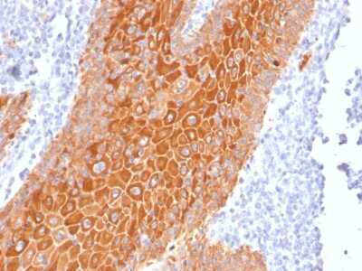 Immunohistochemistry-Paraffin: Cytokeratin, pan Antibody (PAN-CK (Cocktail)) [NBP2-44368]
