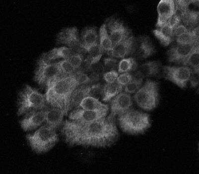 Immunocytochemistry/ Immunofluorescence: Cytokeratin, pan Antibody (PK110) - BSA Free [NBP2-50222]