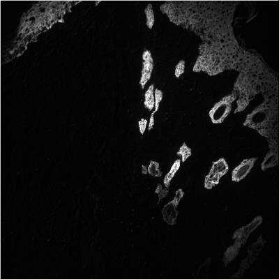 Immunohistochemistry-Frozen: Cytokeratin, pan Antibody (PK110) - BSA Free [NBP2-50222]