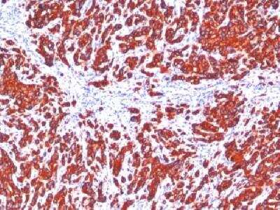 Immunohistochemistry-Paraffin: Cytokeratin, pan Antibody (SPM115 + SPM116) - Azide and BSA Free [NBP2-34394]