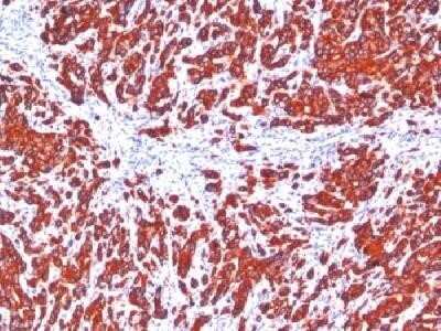 Immunohistochemistry-Paraffin: Cytokeratin, pan Antibody (SPM115 + SPM116) - IHC-Prediluted [NBP2-44370]