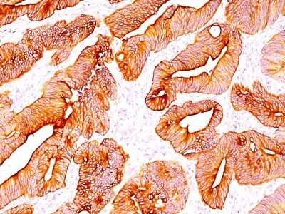 Immunohistochemistry-Paraffin: Cytokeratin, pan Antibody (SPM583) - Azide and BSA Free [NBP2-34433]