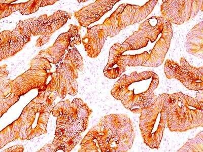 Immunohistochemistry-Paraffin: Cytokeratin, pan Antibody (SPM583) - IHC-Prediluted [NBP2-48197]