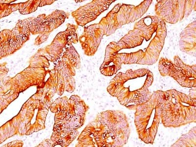 Immunohistochemistry-Paraffin: Cytokeratin, pan Antibody (SPM583) [NBP2-34386]