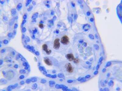 Immunohistochemistry: Cytomegalovirus Antibody (DDG9 and CCH2) [NBP1-22532]