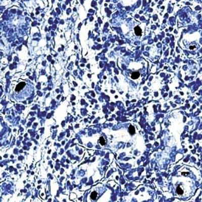 Immunohistochemistry-Paraffin: Cytomegalovirus Antibody (DDG9 and CCH2) [NBP1-22532]