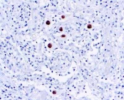 Immunohistochemistry-Paraffin: Cytomegalovirus Antibody (DDG9 and CCH2) [NBP1-22532]