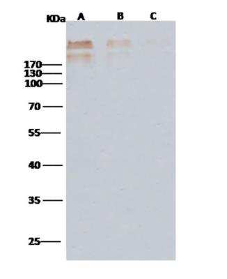 Western Blot: Cytomegalovirus gB Antibody (11B10D3E4) [NBP3-06074]