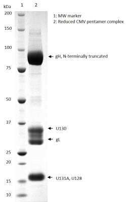 SDS-PAGE: Recombinant Cytomegalovirus Cytomegalovirus gH Pentamer Complex VR1814 His (C-Term) Protein [NBP3-14809]