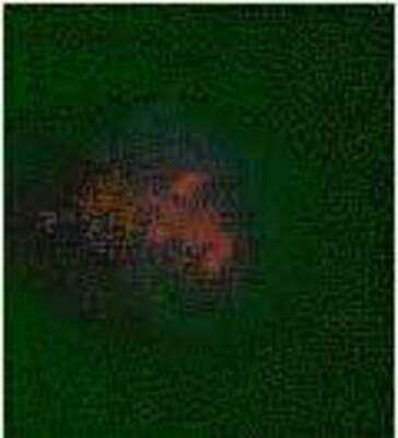 Immunocytochemistry/ Immunofluorescence: 5-MethylCytosine Antibody [NB100-744]