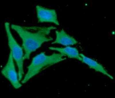 Immunocytochemistry/ Immunofluorescence: Cytosol Nonspecific Dipeptidase (CNDP2)/CPGL Antibody (15E5) - BSA Free [NBP2-22557]