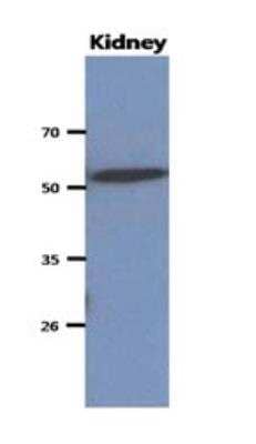 Western Blot: Cytosol Nonspecific Dipeptidase (CNDP2)/CPGL Antibody (15E5)BSA Free [NBP2-22557]