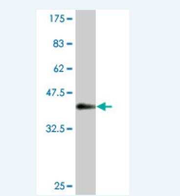 Western Blot: Cytosol Nonspecific Dipeptidase (CNDP2)/CPGL Antibody (1A6) [H00055748-M10]